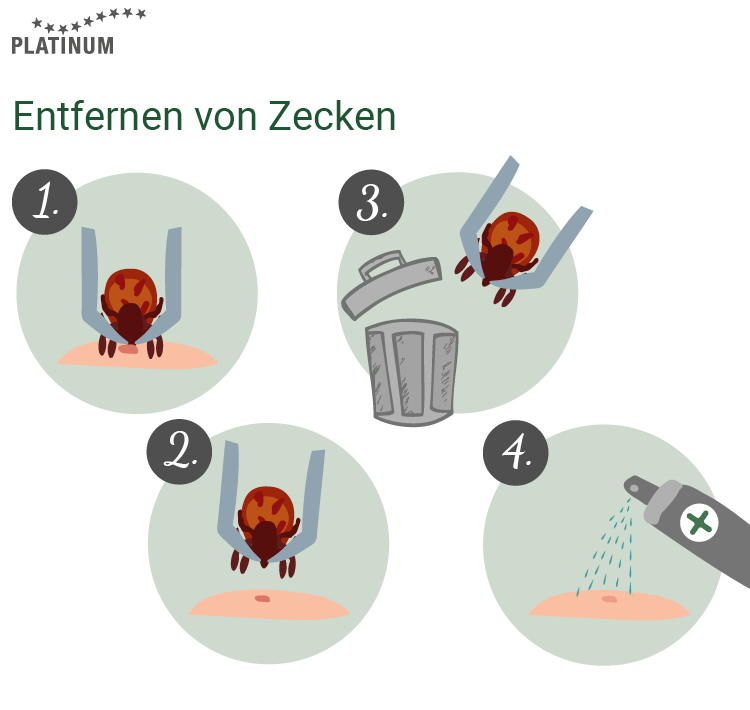 Vier Schritte zur sicheren Zeckenentfernung: die Zecke mit einer Zeckenzange greifen, sie vorsichtig entfernen, entsorgen und die Stelle desinfizieren