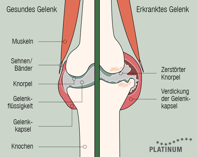 Was passiert bei einer Arthrose im Gelenk eines Hundes? Vergleich eines gesunden Hundegelenks zu einem Gelenk mit Arthrose
