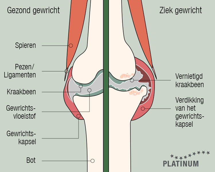 Vergelijking van een gezond hondengewricht met een gewricht met artrose