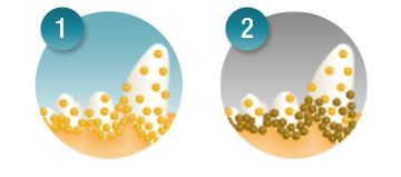 Tartar buildup