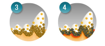 Tartar buildup