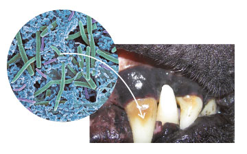 Tartar under an electron microscope